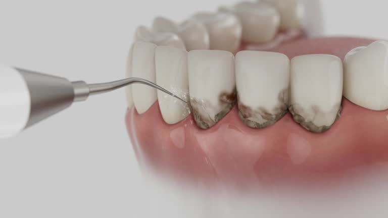 Reliable Dental Implants contractor in Gering, NE by Smile Center Dentistry